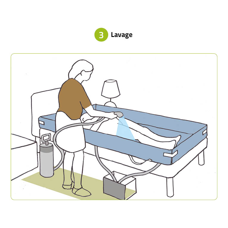 Douche au lit Bagnoletto – Image 5